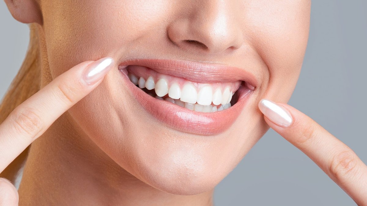 Are 3D Printed Veneers Good? Arnold Dental Explains Cosmetic Dentistry Option