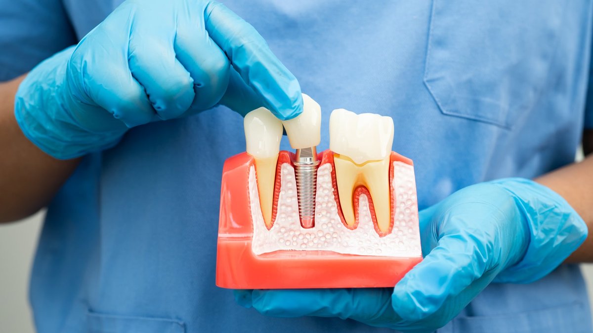 Arnold Dental Broadens Nottingham, UK Access To Care Aided By 3D Printing
