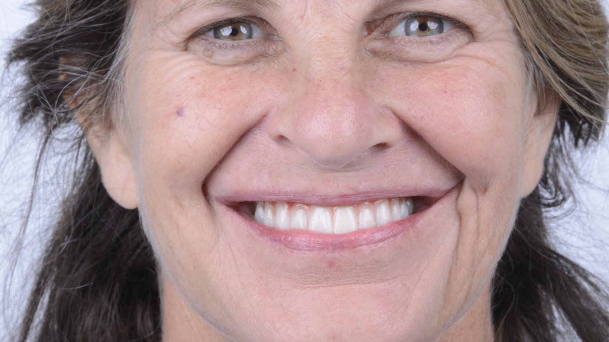 Free Dental Exam: Roseville Implant Specialist Reveals 3D CT Scan Included