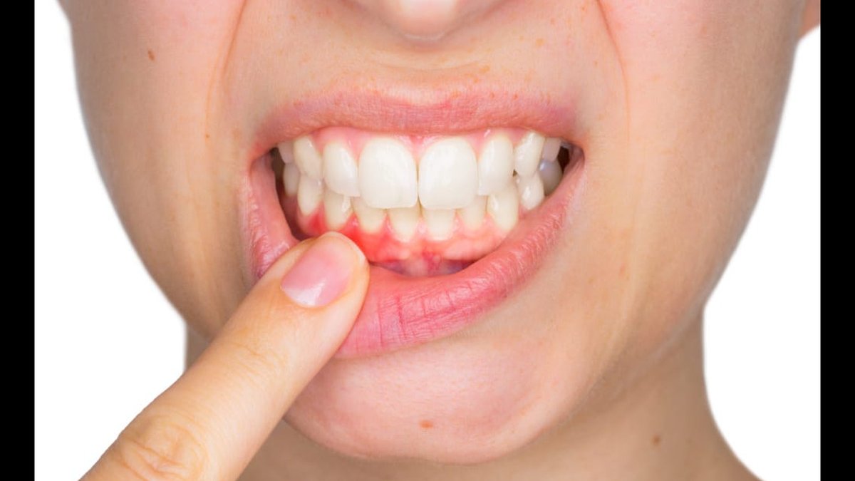 Burlington, NC Teeth Cleaning & Oral Exams: Family Dental Services Expanded