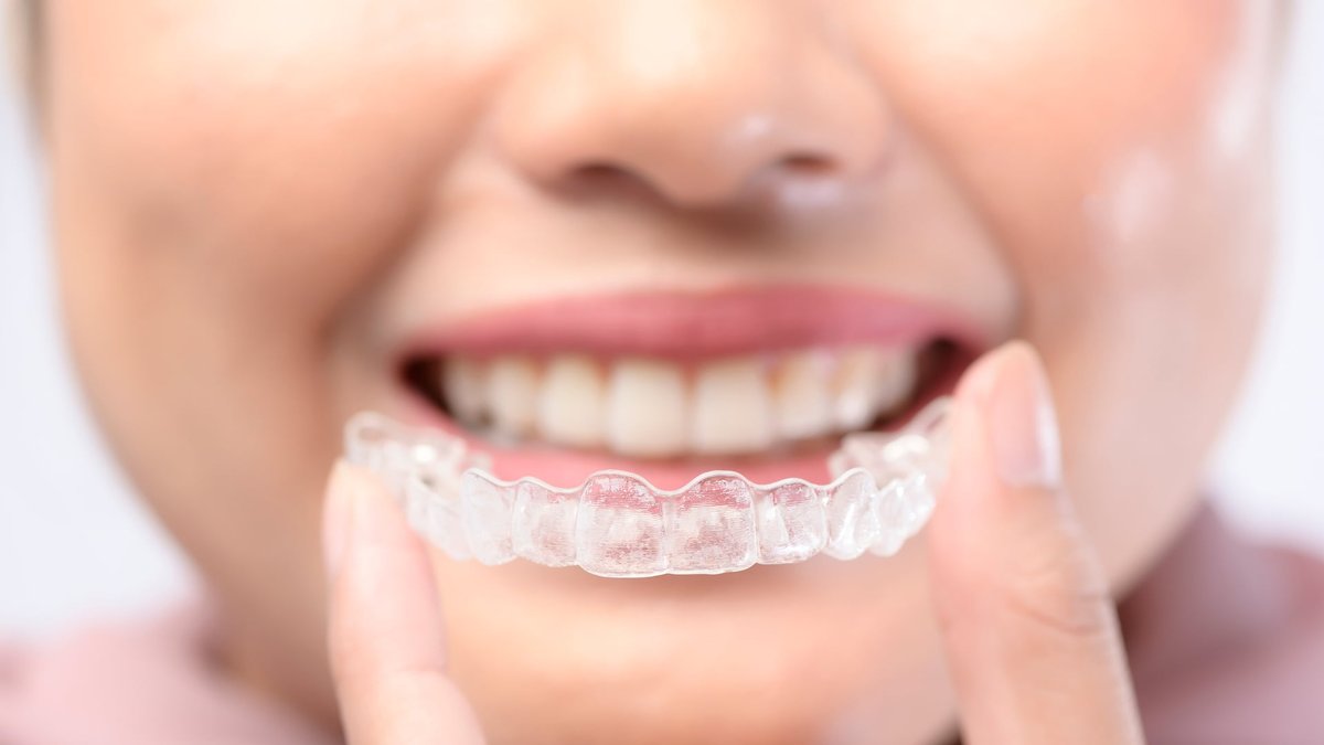 Clear Aligner Cost Breakdown: Frisco Experts Explain What Patients Pay For
