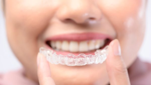How Does Invisalign Work: Nottingham Dentist Explains the Treatment Process