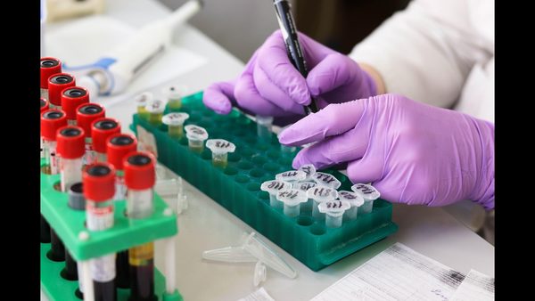 Order Blood Tests Online: Private Lab Testing Without Doctor Referrals Expanded