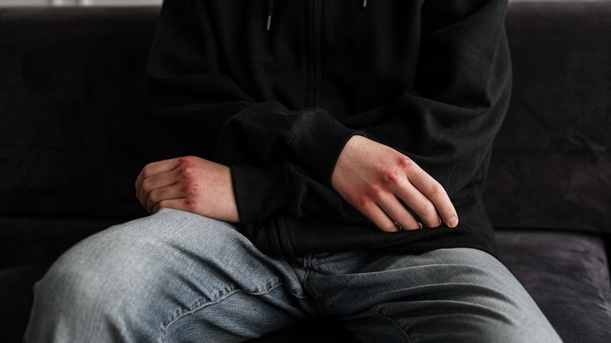 Teen Self-Harm Treatment: Yuba City Expert Explains When and How IOP Can Help